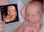 before and after 3d image 3d ultrasound before and after image ultrasound by (A Baby Visit)